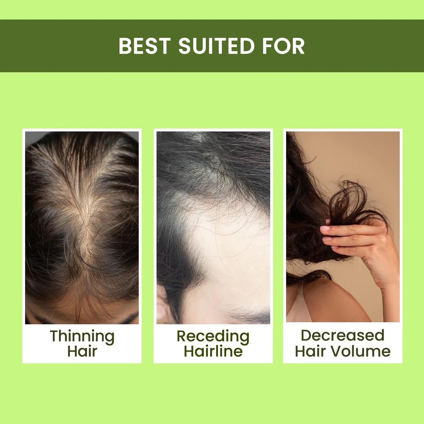 Rosemary Water Hair Regrowth Spray – Buy 1 Get 2 FREE